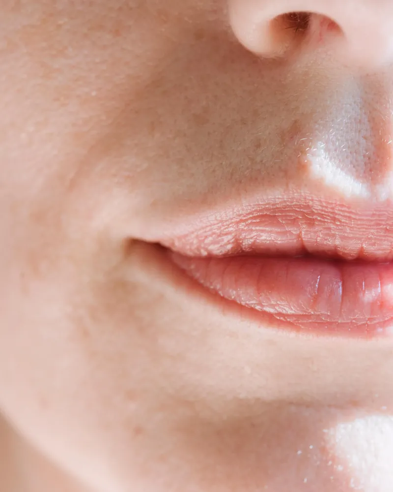 Skinbooster në Tetovë te Dr. Fetai