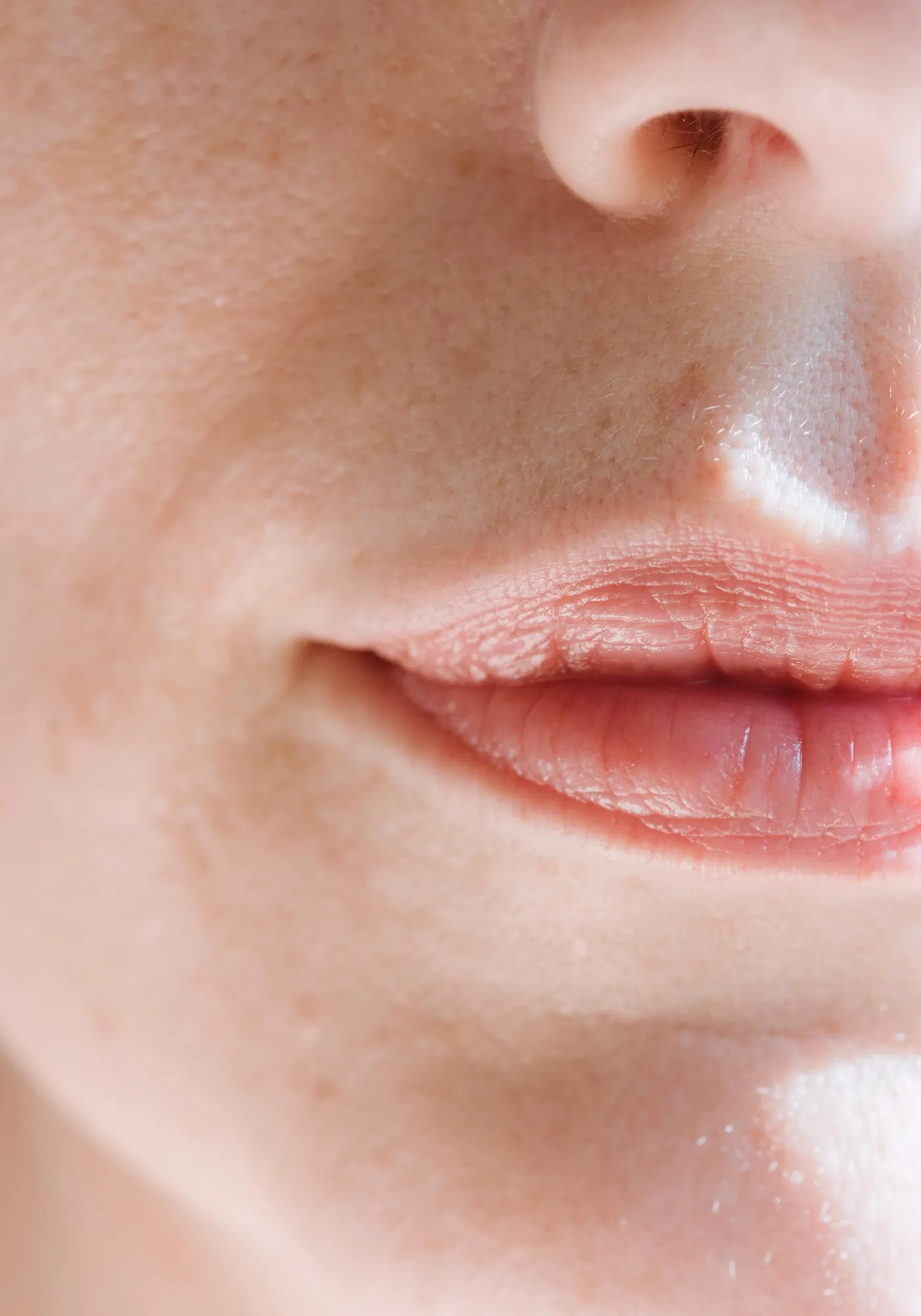 Skinbooster, hidratim i thellë i lëkurës në Tetovë